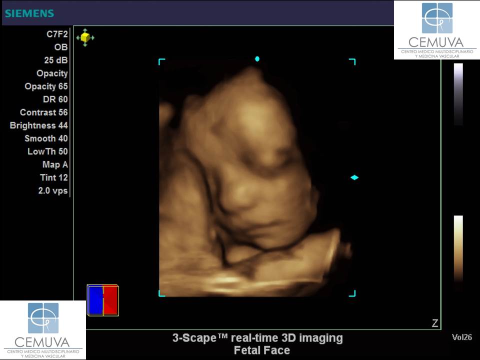 eco-3d-fetal.jpg